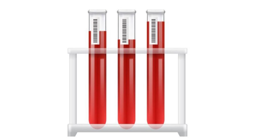 Blood Collection Tubes for Liquid Biopsy Market Size, Share, Growth, Trends and Forecast