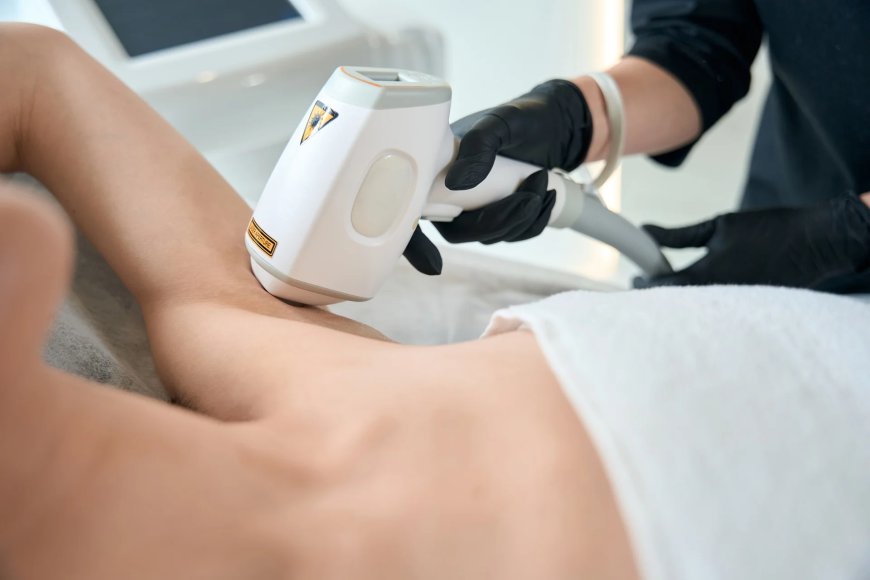 Achieving Smooth Skin: Benefits of Laser Hair Removal