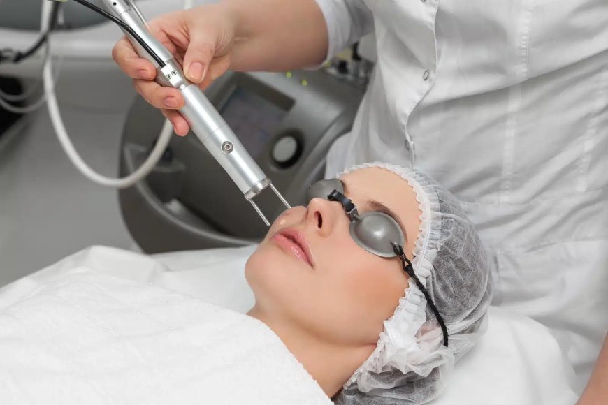 How Laser Treatment for Acne Can Transform Your Skin?