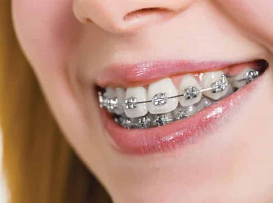 Tips for Choosing Orthodontic Treatments That Suit Your Dubai Life