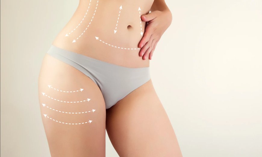 Post Operative Activities What You Can and Cannot Do After Liposuction in Dubai