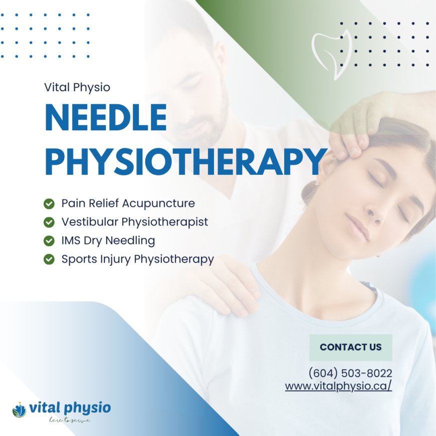 Can Needle Physiotherapy Help with Muscle Tension and Tightness?