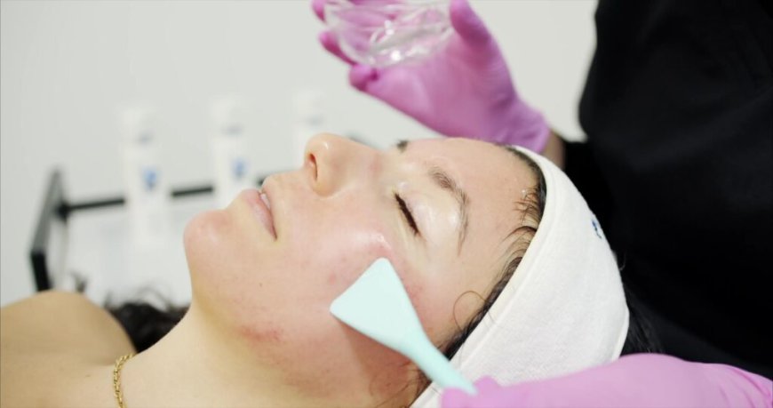 Cost of Chemical Peels in Dubai: What to Expect