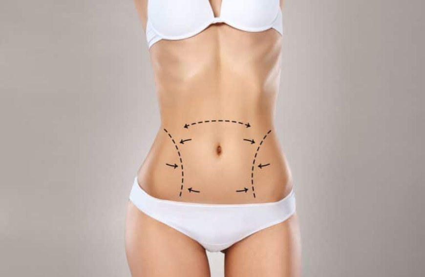 What to Expect During Your First Visit with the Best Liposuction Surgeons in Dubai