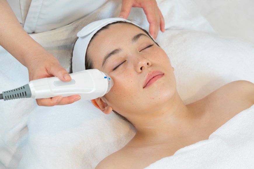 Why Fractional RF Microneedling is Gaining Popularity in Dubai