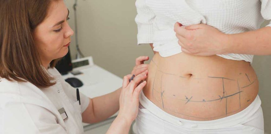 The Science Behind Liposuction: How It Works