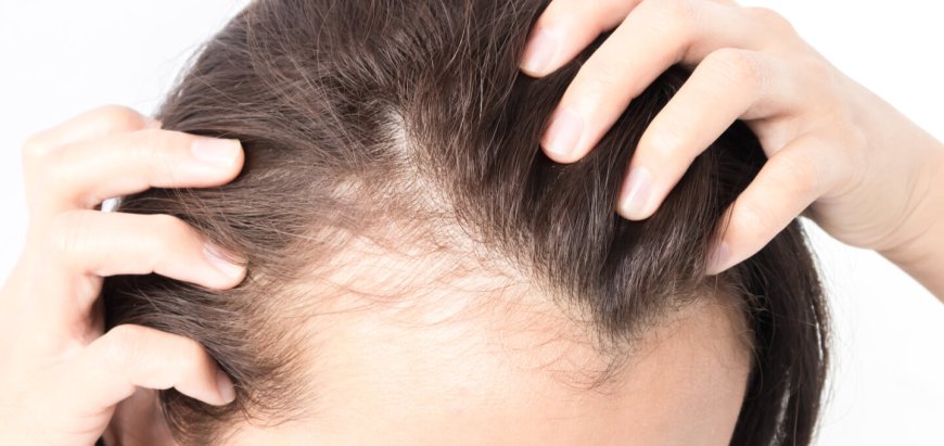 Hair Loss Treatment: Expert Advice for Best Results