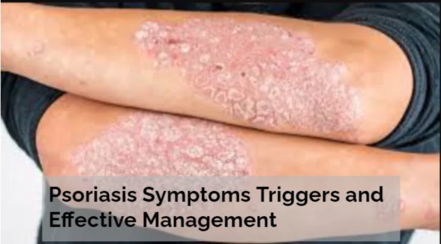 Psoriasis Symptoms Triggers and Effective Management