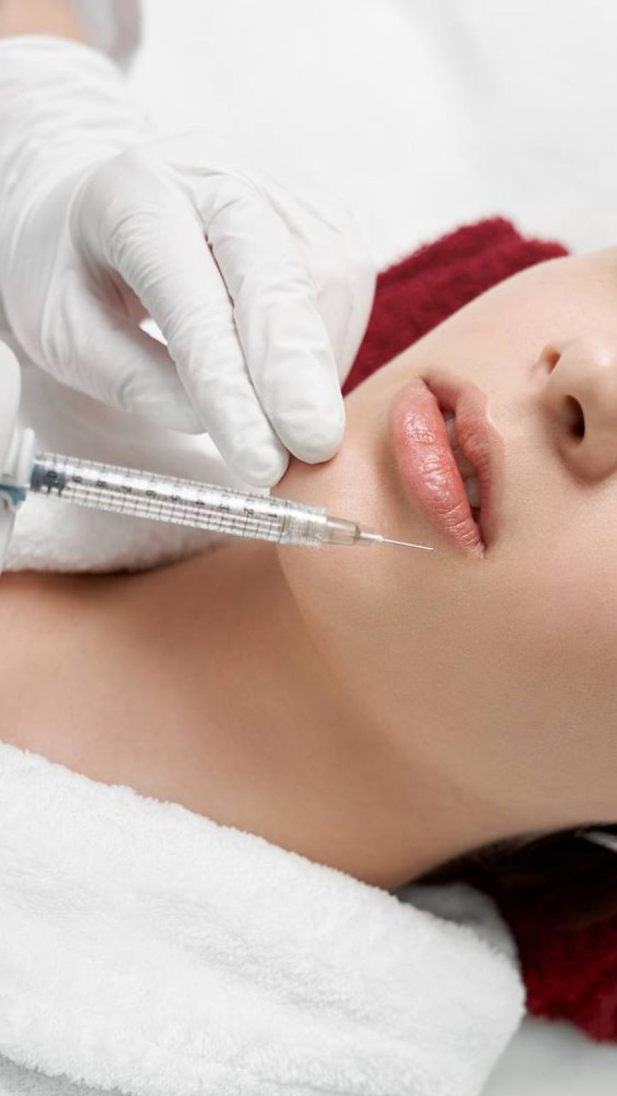 The Pros and Cons of Botox Lip Flip Treatments