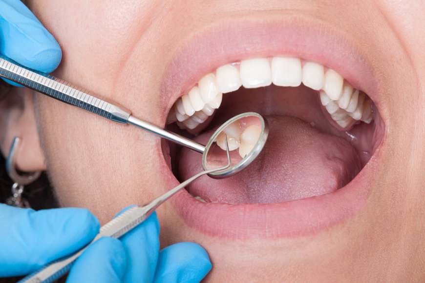 Tooth Extraction Price Guide for Dubai: Essential Tips for a Smooth Experience