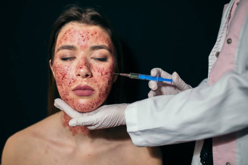 Why the Vampire Facial is a Skincare Must