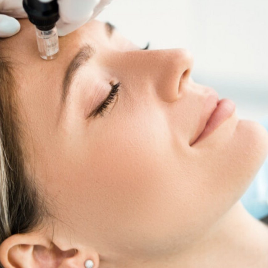 How Morpheus 8 Resurfacing Can Give You the Skin of Your Dreams in Dubai