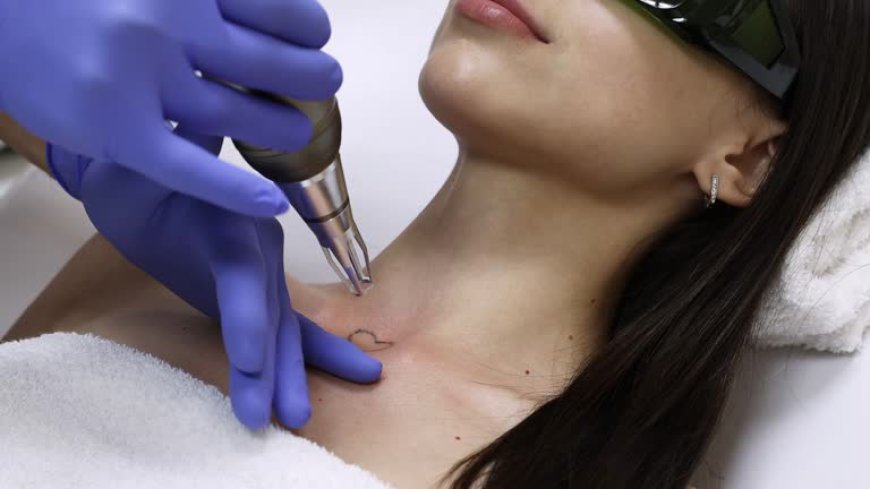 How Dubai’s Clinics Are Reducing Pain in Tattoo Removal