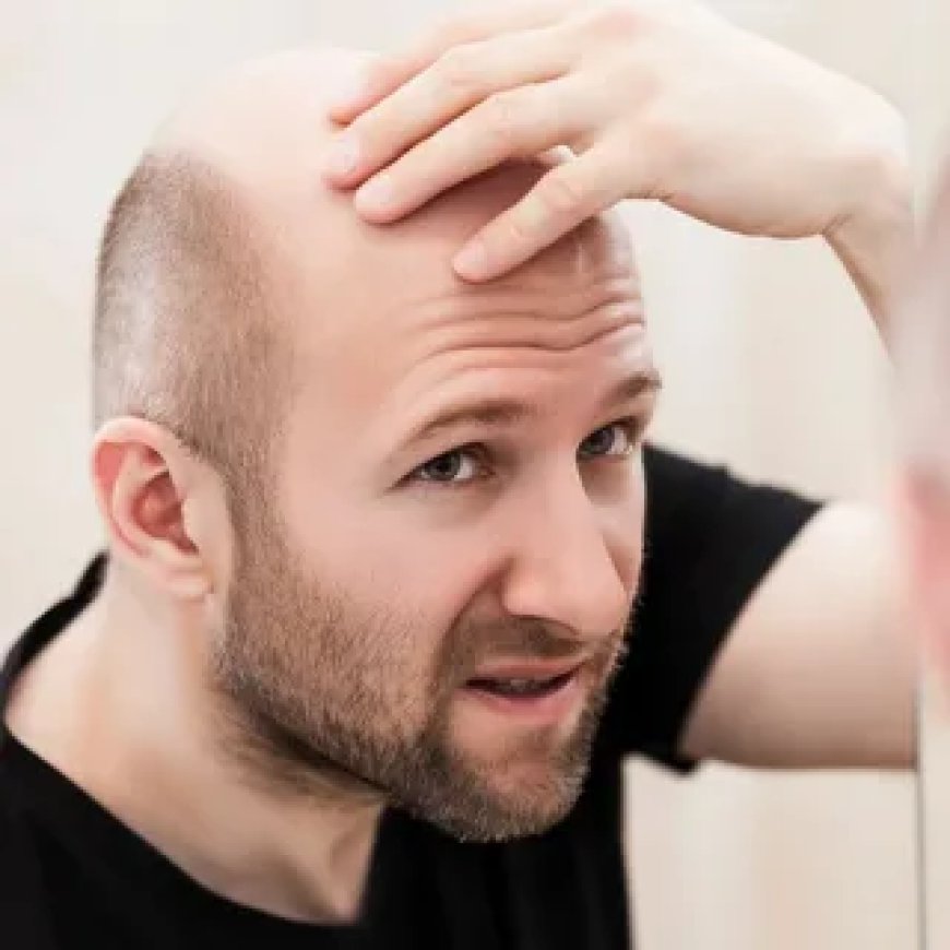 A Day in the Life of a Hair Transplant Patient in Dubai: What to Expect