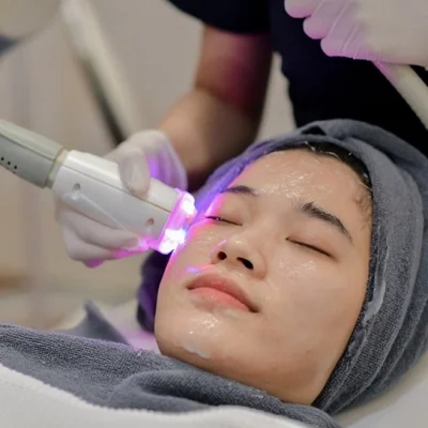 Laser Treatment for Wrinkles and Fine Lines: What to Expect in Dubai