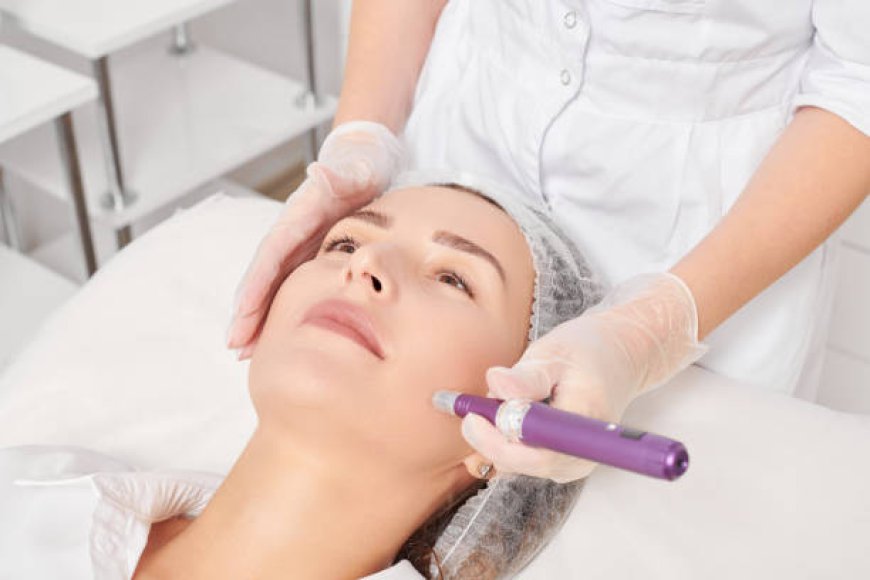 Benefits of SkinPen Microneedling for Flawless Skin