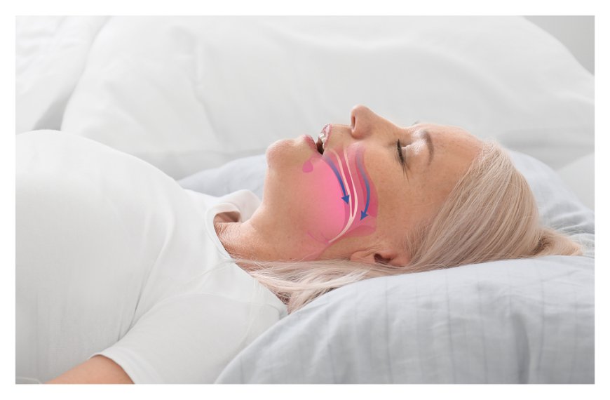 How is obstructive sleep apnea treated, and is there a cure?