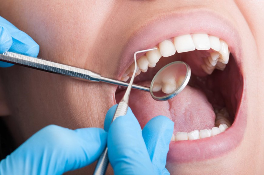 Is a Root Canal Painful? Here’s the Truth