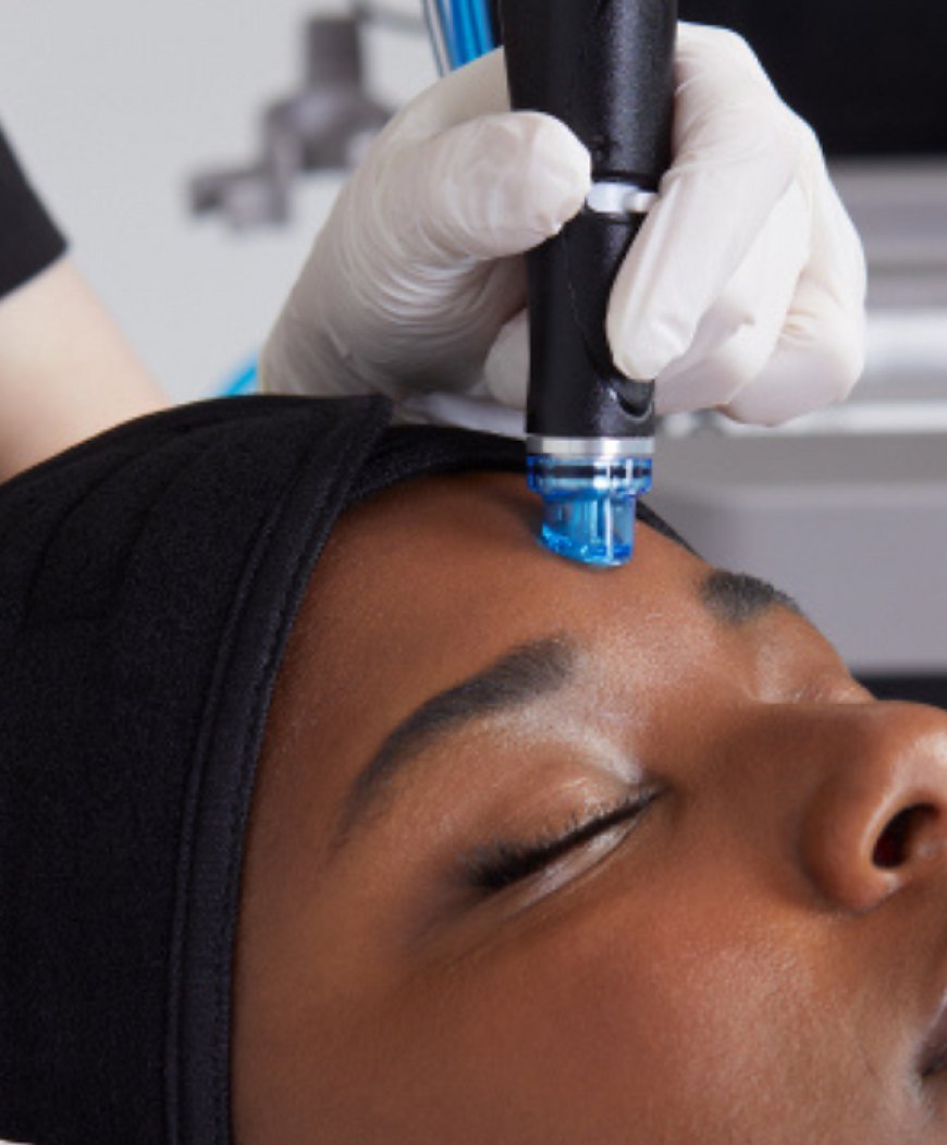 Experience a Skin Glow-Up with Hydrafacial