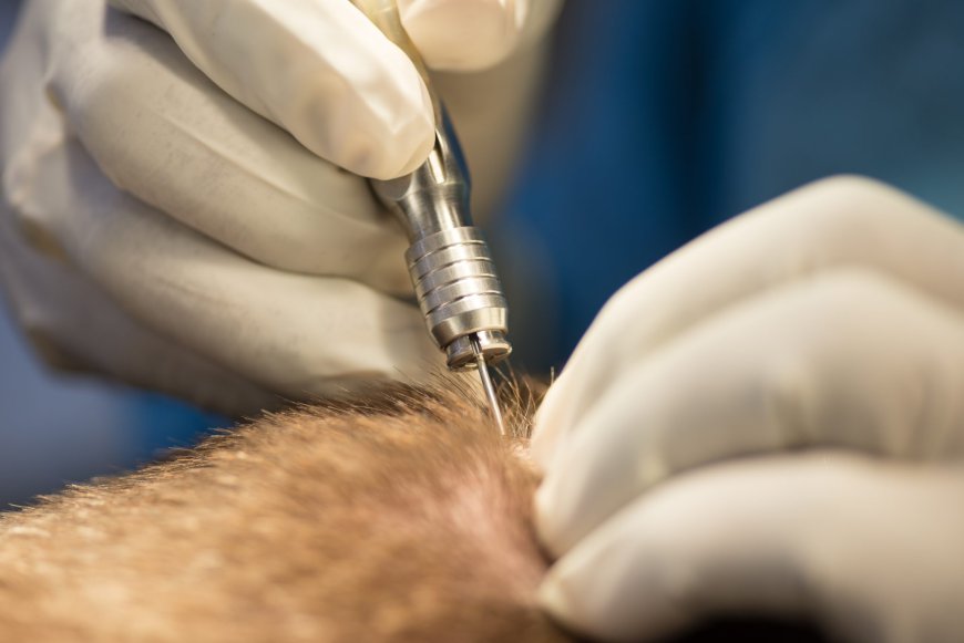 Hair Transplant Cost: Comparing Prices Across Clinics in 2024