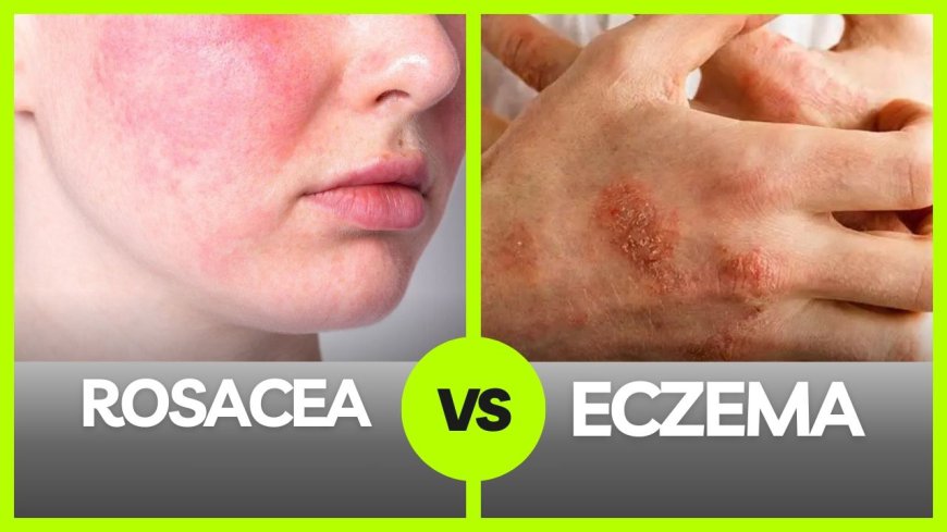 How to Identify Eczema and Rosacea on the Face: A Guide