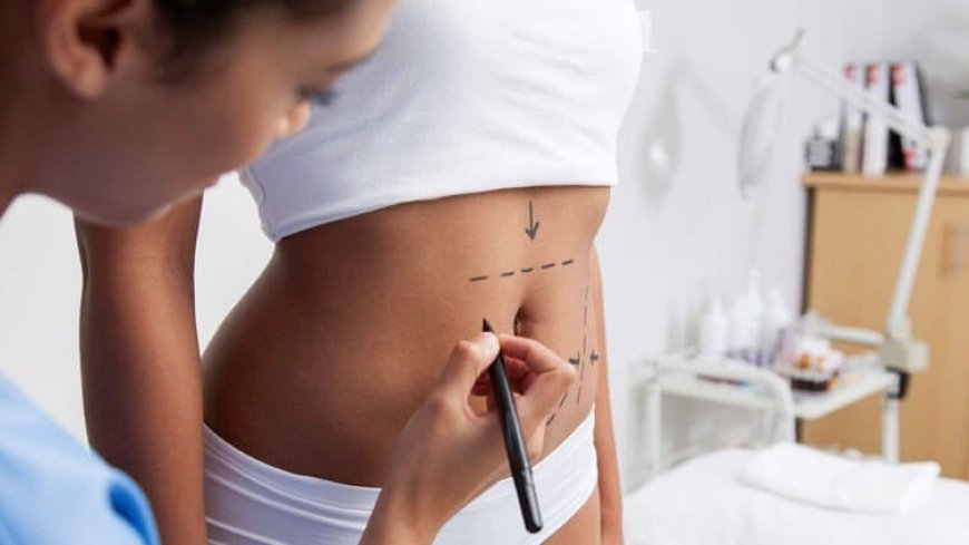 Your Complete Guide to Tummy Tuck Surgery in Dubai