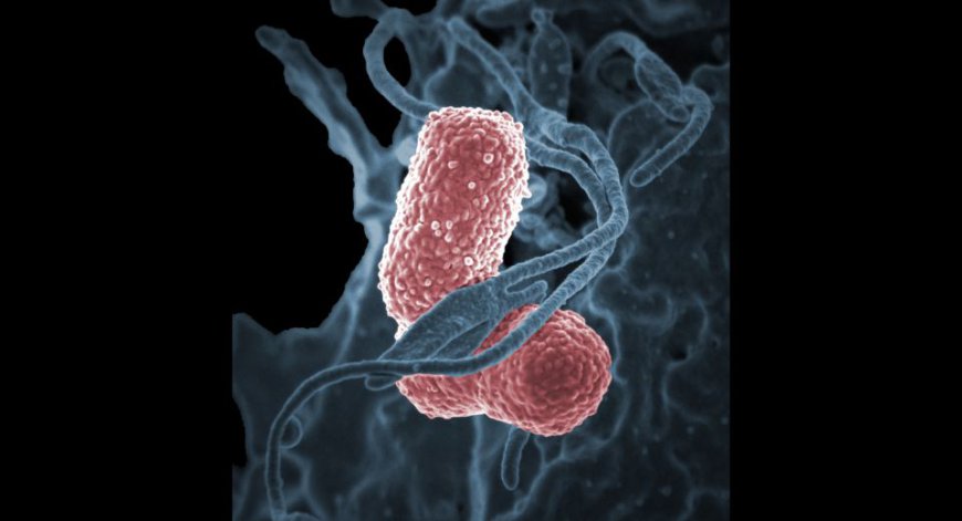 Carbapenem Market Size, Share, Growth, Trends and Forecasts 2031