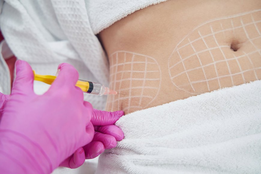 Can Fat-Melting Injections Be Used for Tummy Tucks Without Surgery in Dubai?