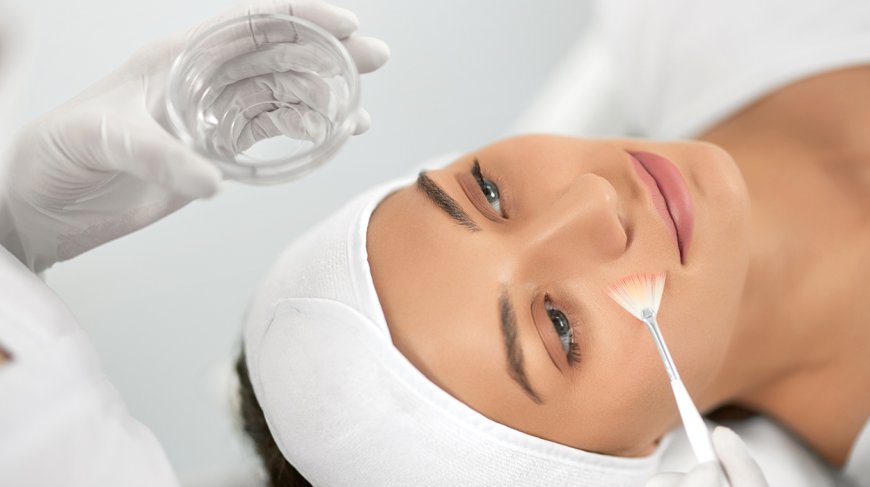 The Pros and Cons of Chemical Peels for Skin Renewal in Dubai