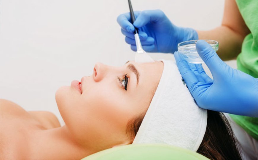 The Pros and Cons of Chemical Peels for Skin Renewal in Dubai