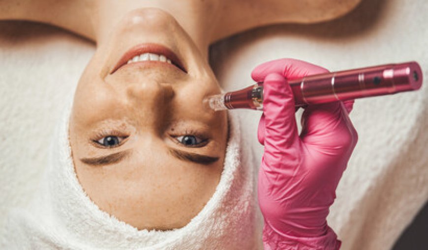 Preparing for Your Dermapen Appointment: A Pre-Treatment Checklist