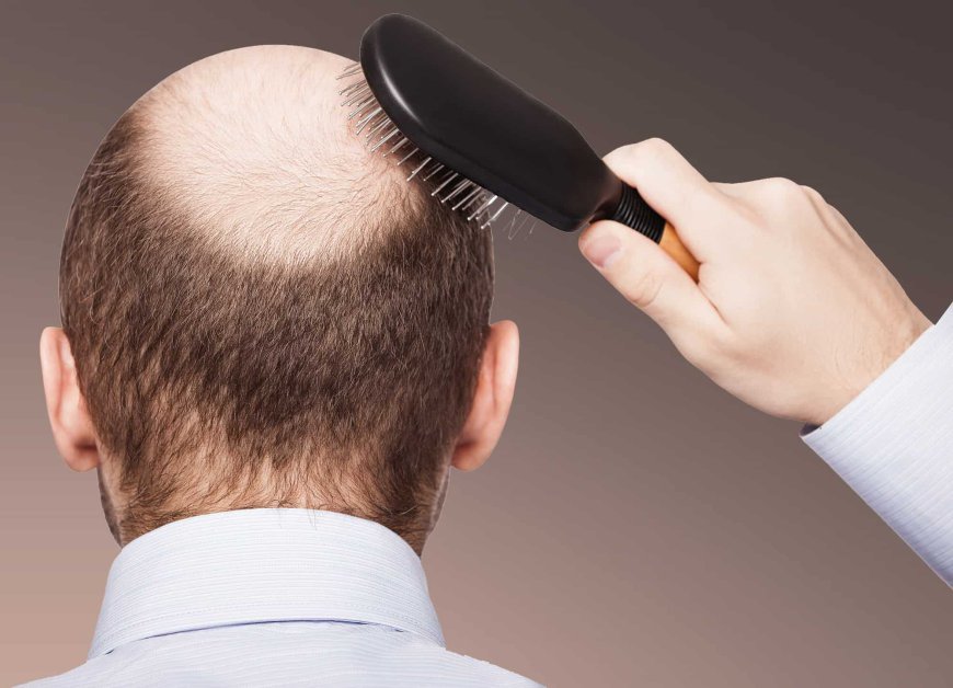 What Impacts Hair Transplant Cost in Dubai’s Competitive Market?