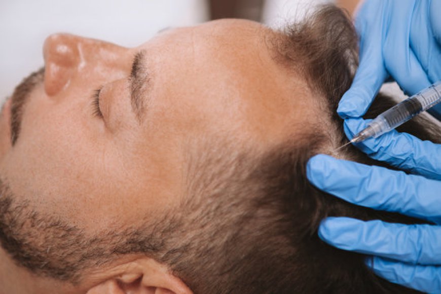 Best Hair Transplant Treatments: FUE, DHI, or FUT?