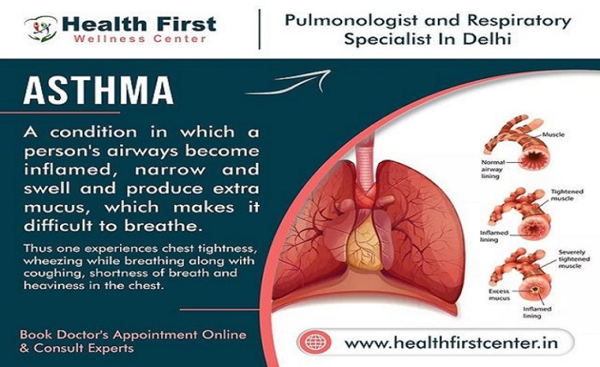 Find the Best Asthma Specialist Doctor Near Me: Expert Care by Dr. Sanchayan Roy