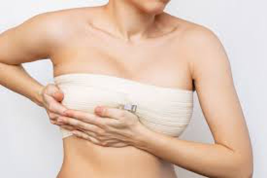 The Recovery Process After Breast Augmentation: What to Expect