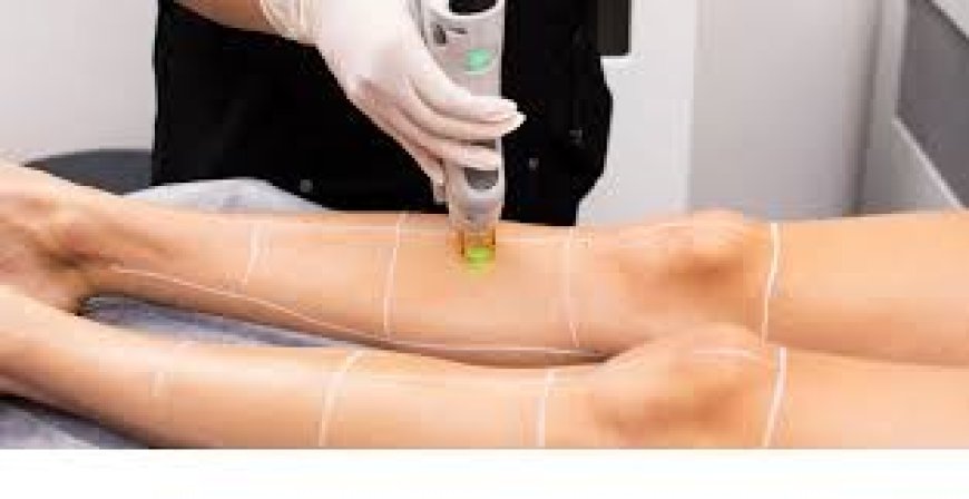 Long-Lasting Results: Laser Hair Removal in Riyadh