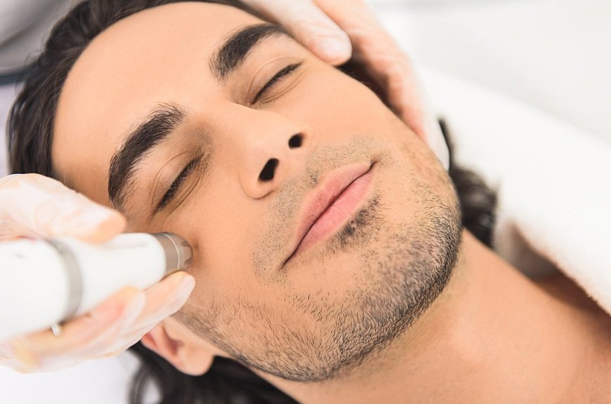 The Role of RF Energy in Fractional RF Microneedling for Skin Tightening