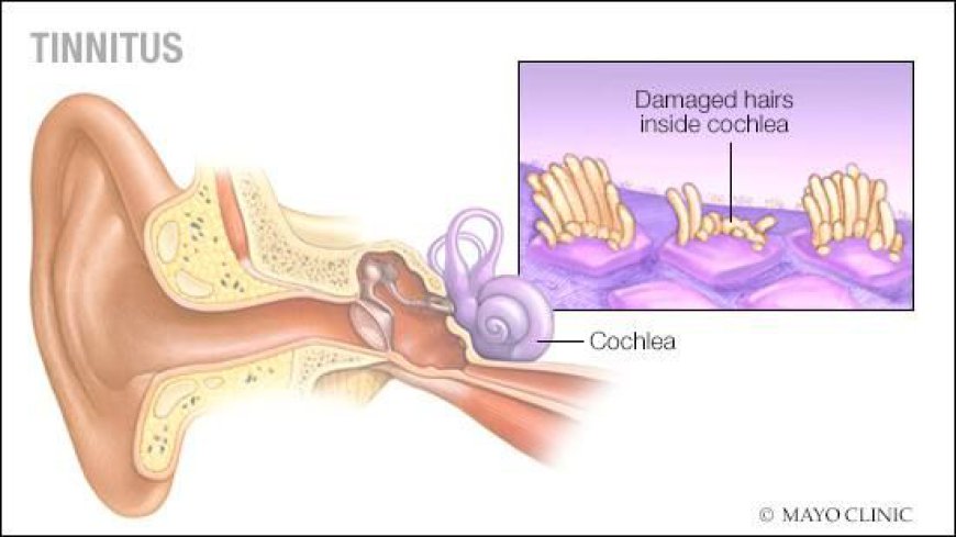 Guide to Pure Tone Audiometry Test Price and Tinnitus Treatment in Lahore