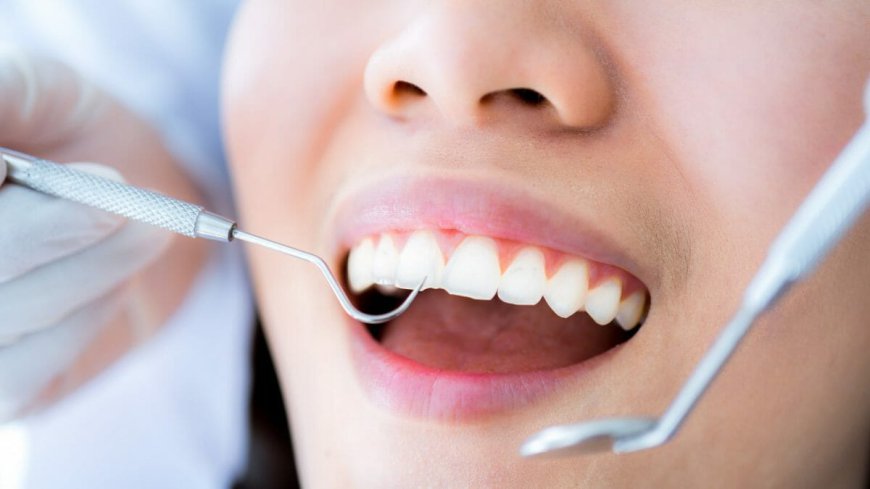 Teeth Cleaning: A Key Component of Your Self-Care Routine