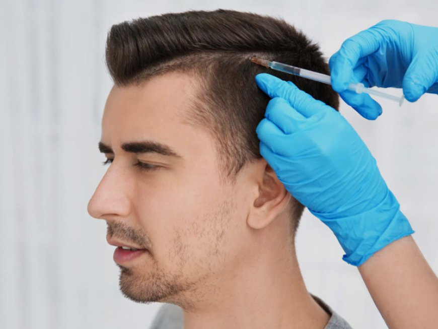 Hair Transplant Financing in Dubai: Options to Consider