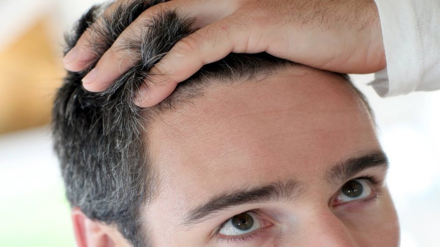 Hidden Costs of Hair Transplants in Dubai: What You Should Know