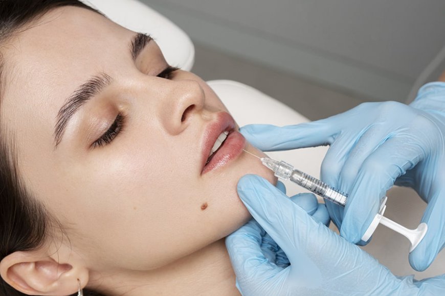 How long do dermal fillers last?