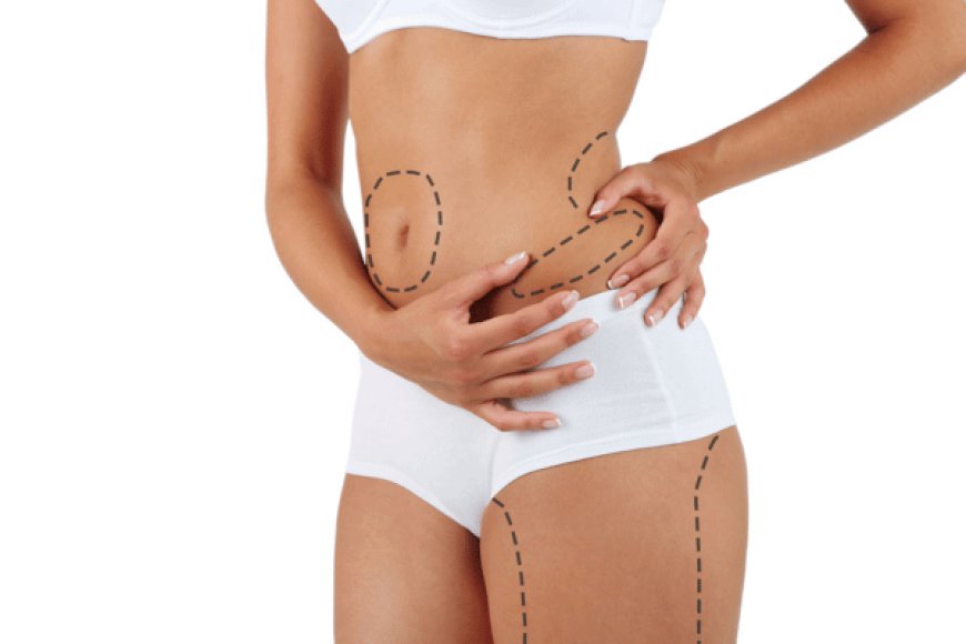 Laser Liposuction Recovery: Tips for a Smooth Healing Process