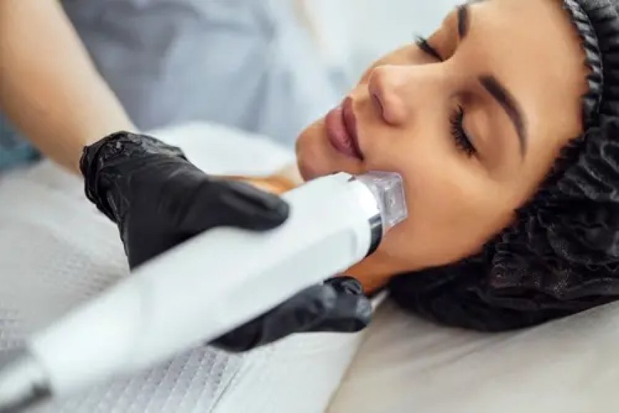 How Does Fractional RF Microneedling Treat Enormous Pores in Dubai?