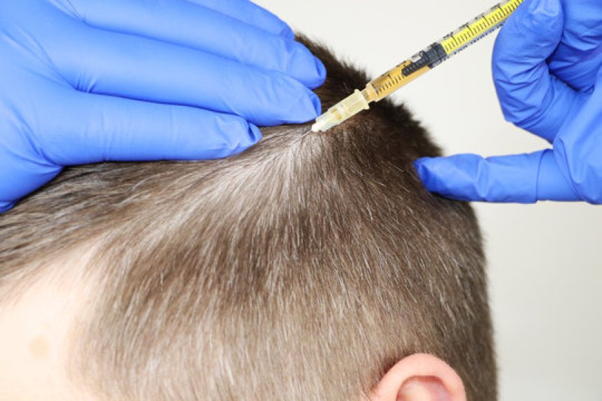 How Often Should You Get Hair Plasma Treatments?