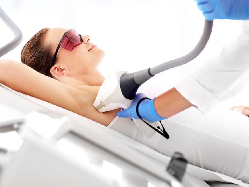 Can laser hair removal treat the underarms?