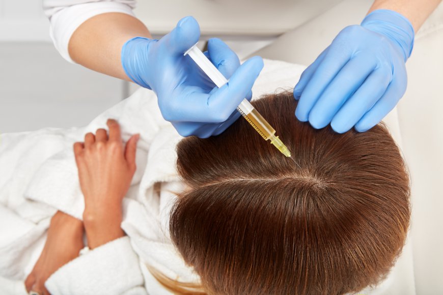 Maintaining Hair Health After PRP Treatment