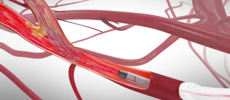 Peripheral Vascular Devices Market will grow at highest pace owing to increasing geriatric population growth.