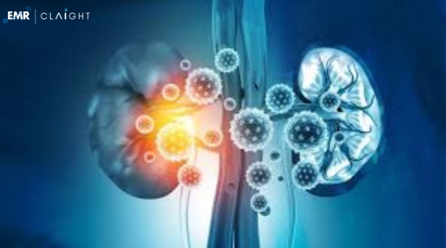 Global Acute Kidney Injury Treatment Market Size, Share, Growth, Trends, Key Players, & Forecast | 2024-2032