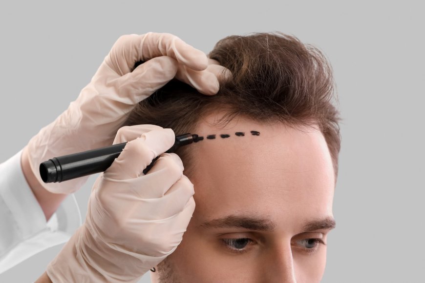 How to Spot a Reliable Hair Transplant Clinic